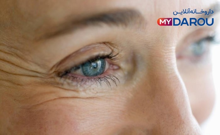 بهترین کرم دور چشم برای زیر 30 سال 